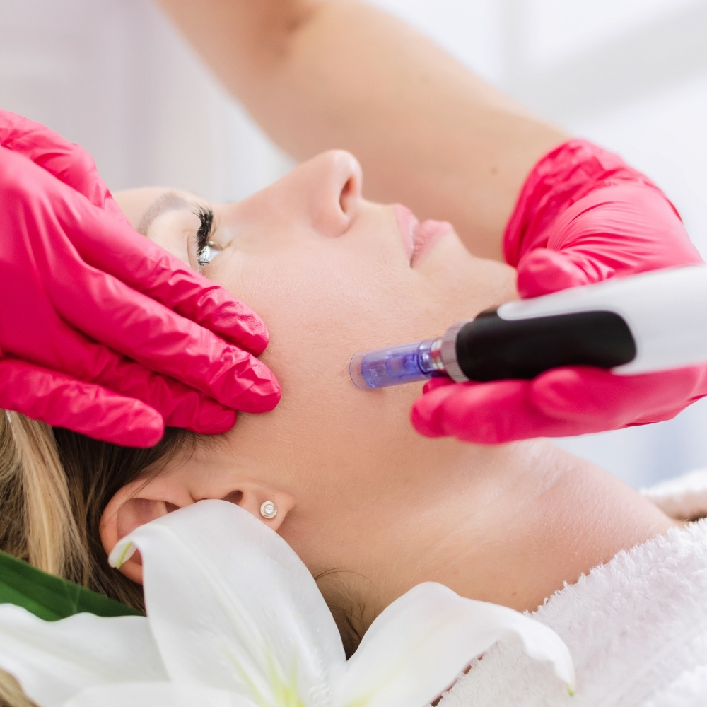 Mikro iğneleme Dermapen — Eskişehir